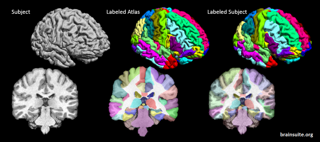 BCI-DNI_brain_atlas_subject_mapped2