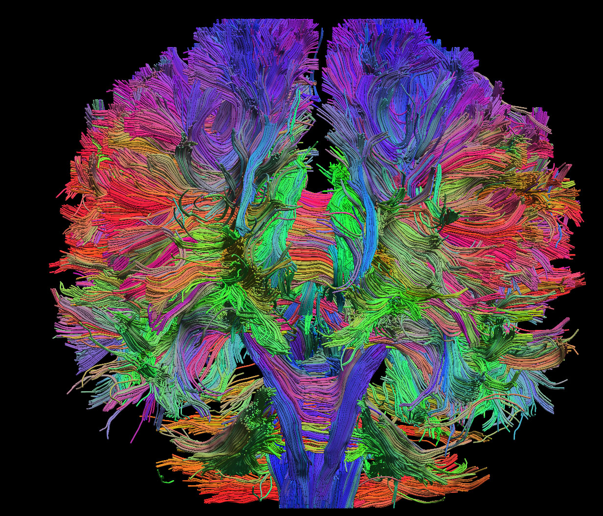 BrainSuite | magnetic resonance image analysis tools